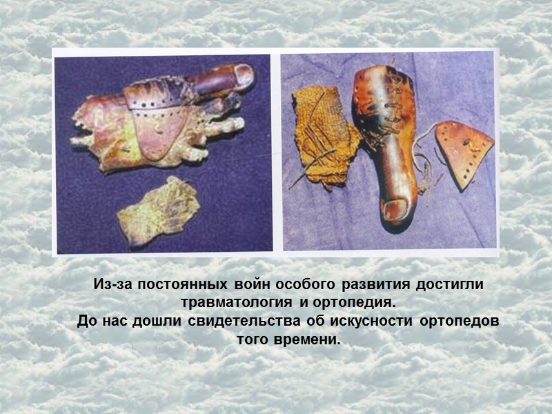 Из-за постоянных войн особого развития достигли травматология и ортопедия.  До нас дошли свидетельства